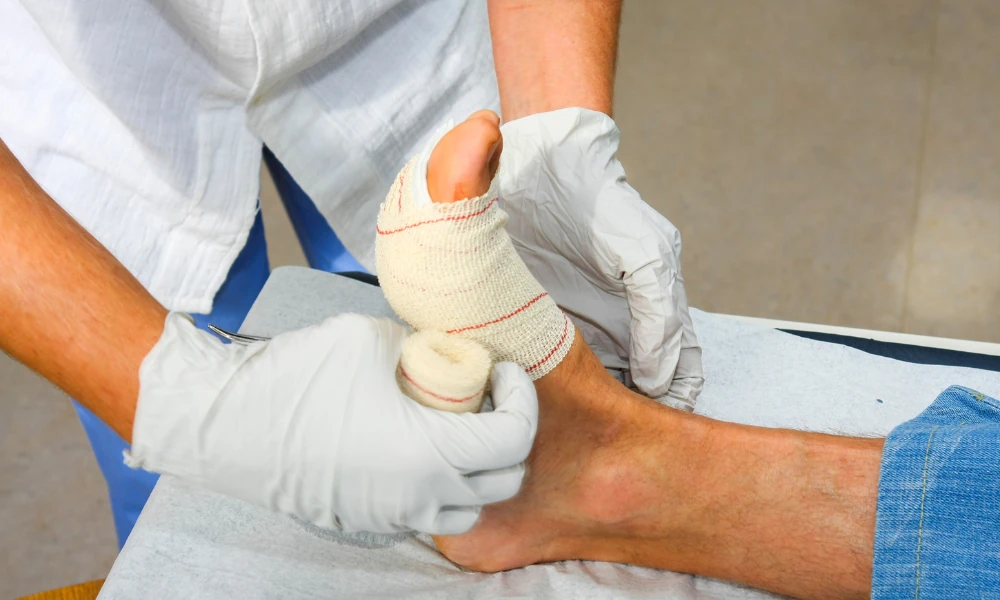 What Should You Know About PAD?
